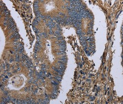 Invitrogen GANP Polyclonal Antibody 100 &mu;L; Unconjugated:Antibodies,