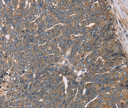 Invitrogen HSD17B12 Polyclonal Antibody 100 &mu;L; Unconjugated:Antibodies,