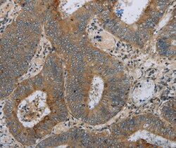 Invitrogen HSD17B14 Polyclonal Antibody 100 &mu;L; Unconjugated:Antibodies,