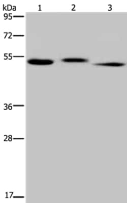Invitrogen HYAL3 Polyclonal Antibody 100 &mu;L; Unconjugated:Antibodies,