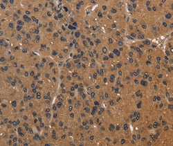 ICAM-4 Polyclonal Antibody:Antibodies, Polyclonal