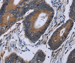 Importin 4 Polyclonal Antibody, Invitrogen 100 &mu;L; Unconjugated:Antibodies,
