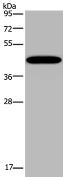 Invitrogen KCNK13 Polyclonal Antibody 100 &mu;L; Unconjugated:Anticuerpos