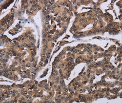 Invitrogen KIF1C Polyclonal Antibody 100 &mu;L; Unconjugated:Antibodies,