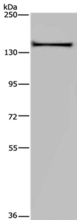 Invitrogen KIF1C Polyclonal Antibody 100 &mu;L | Buy Online | Invitrogen&trade; | Fisher Scientific