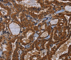 Invitrogen LRRC57 Polyclonal Antibody 100 &mu;L; Unconjugated:Antibodies,