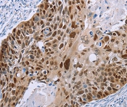 MAGEA10 Polyclonal Antibody:Antibodies, Polyclonal