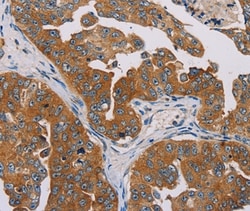 Invitrogen MBNL3 Polyclonal Antibody 100 &mu;L; Unconjugated:Antibodies,