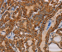 Invitrogen MBNL3 Polyclonal Antibody 100 &mu;L; Unconjugated:Antibodies,