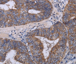 Invitrogen MT3 Polyclonal Antibody 100 &mu;L; Unconjugated:Antibodies,
