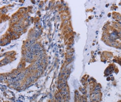 Invitrogen MT3 Polyclonal Antibody 100 &mu;L; Unconjugated:Antibodies,