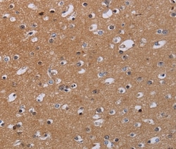 MKKS Polyclonal Antibody:Antibodies, Polyclonal