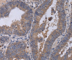 MKKS Polyclonal Antibody:Antibodies, Polyclonal