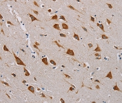 Invitrogen CMC4 Polyclonal Antibody 100 &mu;L; Unconjugated:Antibodies,