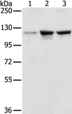 Invitrogen NAT10 Polyclonal Antibody 100 &mu;L | Buy Online | Invitrogen&trade; | Fisher Scientific