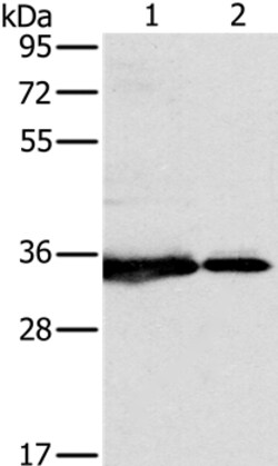 Invitrogen NDUFAF1 Polyclonal Antibody 100 &mu;L | Buy Online | Invitrogen&trade; | Fisher Scientific