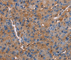 Invitrogen Neuroligin 1 Polyclonal Antibody 100 &mu;L; Unconjugated:Antibodies,