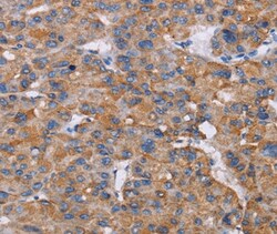 Invitrogen NIT1 Polyclonal Antibody 100 &mu;L; Unconjugated:Antibodies,