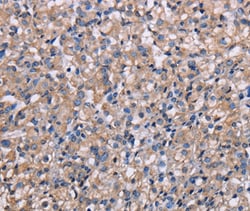 Invitrogen NIT1 Polyclonal Antibody 100 &mu;L; Unconjugated:Antibodies,