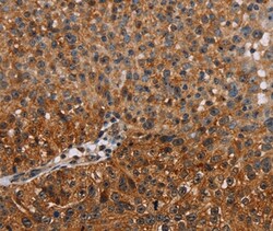 Invitrogen NMT2 Polyclonal Antibody 100 &mu;L; Unconjugated:Anticuerpos