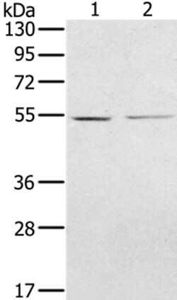 Invitrogen NMT2 Polyclonal Antibody 100 &mu;L; Unconjugated:Anticuerpos