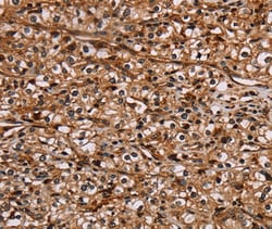Invitrogen NOC2L Polyclonal Antibody 100 &mu;L; Unconjugated:Antibodies,
