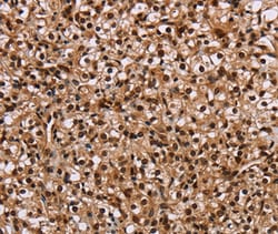 Invitrogen HMGN5 Polyclonal Antibody 100 &mu;L | Buy Online | Invitrogen&trade; | Fisher Scientific