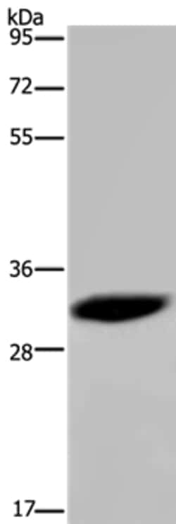 Invitrogen HMGN5 Polyclonal Antibody 100 &mu;L | Buy Online | Invitrogen&trade; | Fisher Scientific