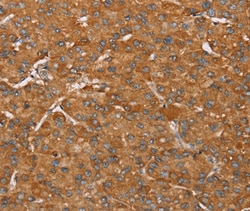 Invitrogen PAGE5 Polyclonal Antibody 100 &mu;L; Unconjugated:Antibodies,