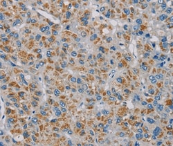 Invitrogen PNLIP Polyclonal Antibody 100 &mu;L; Unconjugated:Antibodies,