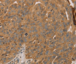 Invitrogen PARP11 Polyclonal Antibody 100 &mu;L; Unconjugated:Antibodies,