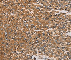 Invitrogen PARP11 Polyclonal Antibody 100 &mu;L; Unconjugated:Antibodies,