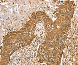 Invitrogen RASSF9 Polyclonal Antibody 100 &mu;L; Unconjugated:Antibodies,
