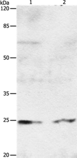 Invitrogen RAB8A Polyclonal Antibody 100 &mu;L; Unconjugated:Antibodies,