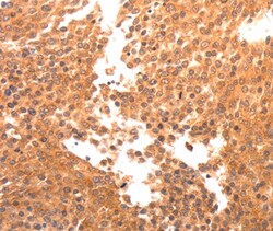 BDKRB2 Polyclonal Antibody, Invitrogen 100 &mu;L; Unconjugated:Antibodies,