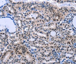 Invitrogen COX18 Polyclonal Antibody 100 &mu;L; Unconjugated:Antibodies,