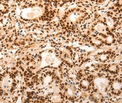E2F7 Polyclonal Antibody:Antibodies, Polyclonal