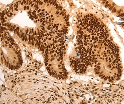 E2F7 Polyclonal Antibody:Antibodies, Polyclonal