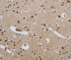 Invitrogen CMTM8 Polyclonal Antibody 100 &mu;L; Unconjugated:Antibodies,