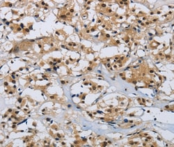Invitrogen CMTM8 Polyclonal Antibody 100 &mu;L; Unconjugated:Antibodies,