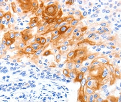 SLC2A11 Polyclonal Antibody:Antibodies, Polyclonal