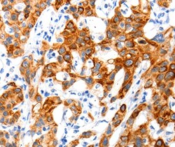 SLC2A11 Polyclonal Antibody:Antibodies, Polyclonal
