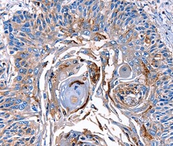 LRP2 Polyclonal Antibody:Antibodies, Polyclonal