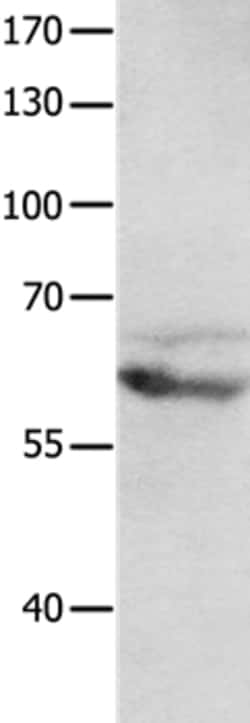Invitrogen mGluR8 Polyclonal Antibody 100 &mu;L; Unconjugated:Antibodies,