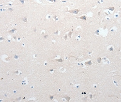GCH1 Polyclonal Antibody:Antibodies, Polyclonal
