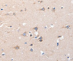 Invitrogen KCNH8 Polyclonal Antibody 100 &mu;L; Unconjugated:Antibodies,