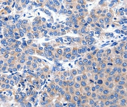 Invitrogen KCNH8 Polyclonal Antibody 100 &mu;L; Unconjugated:Antibodies,