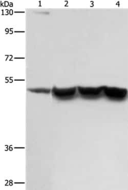 Invitrogen ING1 Polyclonal Antibody 100 &mu;L | Buy Online | Invitrogen&trade; | Fisher Scientific