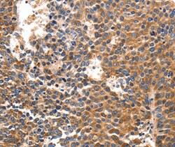 Invitrogen IRF1 Polyclonal Antibody 100 &mu;L; Unconjugated:Antibodies,