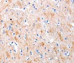 Invitrogen KISS1 Polyclonal Antibody 100 &mu;L; Unconjugated:Antibodies,